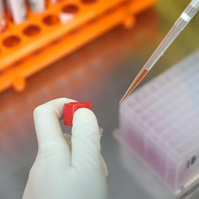 Kit de test RT PCR Monkeypox Virus MPXV CE enregistré 1 test/boîte